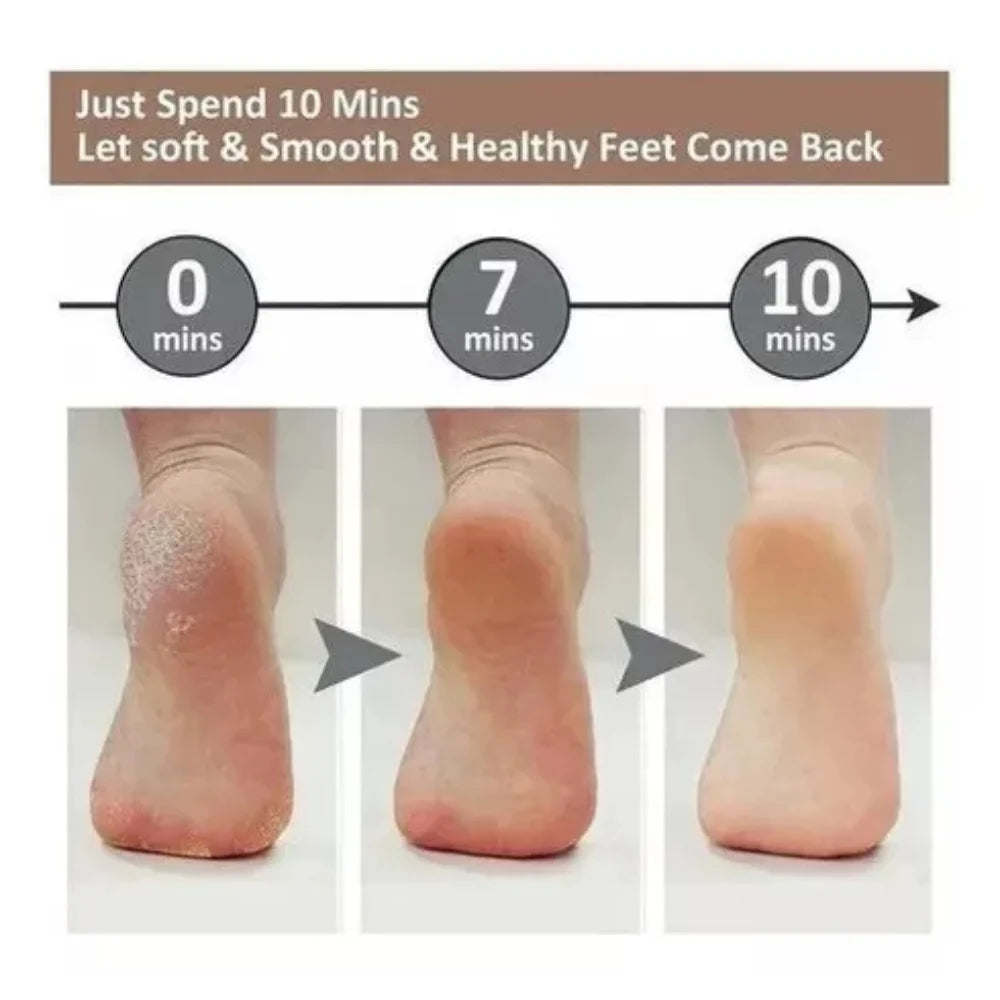USB Rechargeable Electric Callus Remover Cordless Foot Sander Pedicure Tool