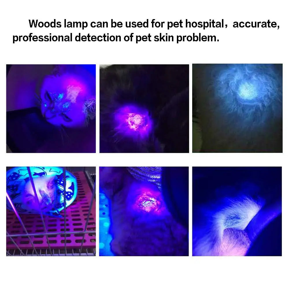 Wood Lamp UV Skin Analyzer - Professional Facial Skin Diagnostic Device with 3x Magnifier