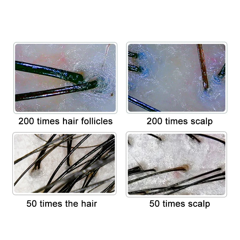 10-Inch (25.4 cm) LCD Scalp & Hair Analyzer Microscope 50X/200X Digital Skin and Follicle Detector