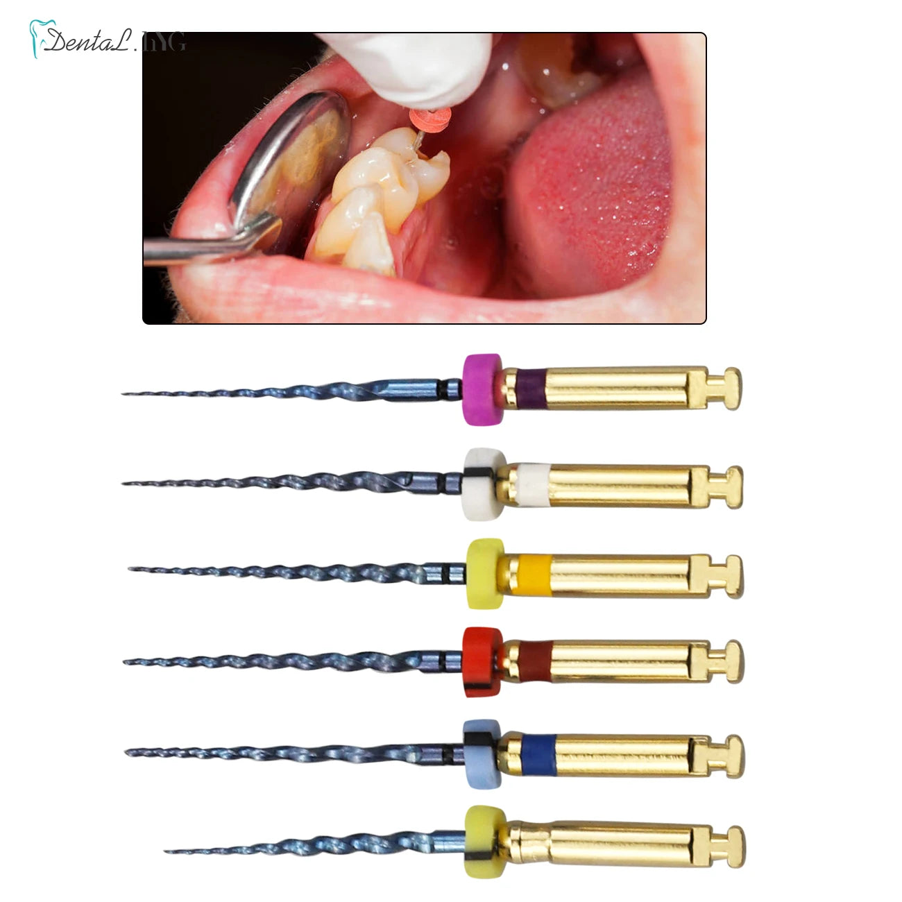 Gold-Coated NiTi Rotary Root Canal Files 6-Pack - Endodontic Files 19mm (0.75in) & 21mm (0.83in)